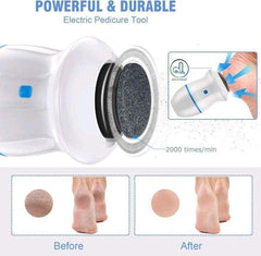 پارسل کھولیں، تسلی کے بعد پیمنٹ کریں  Electric Foot Callus Remover With Built-in Vacuum